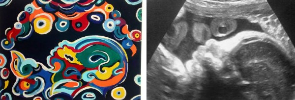 https://www.magicmum.com/wp-content/uploads/estate/ses.sheologydigital.com/uploads/baby-1_15_w600.jpg